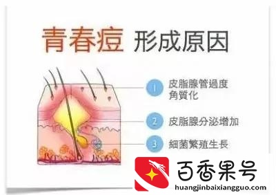 去医院皮肤科看痘痘真的靠谱吗？