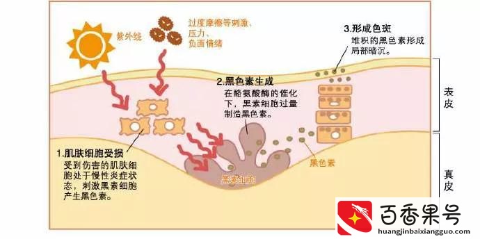 去医院皮肤科看痘痘真的靠谱吗？